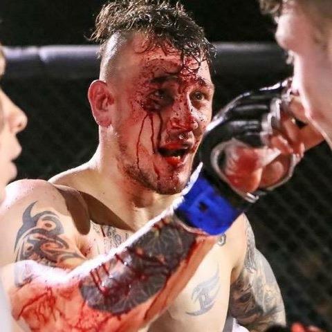 David Round is streaming with blood